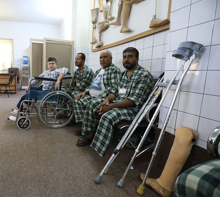 جاسم ومرضى آخرون ينتظرون تركيب الأطراف الاصطناعية في مركز تقويم العظام للطوارئ في السليمانية جاسم ومرضى آخرون ينتظرون تركيب الأطراف الاصطناعية في مركز تقويم العظام للطوارئ في السليمانية