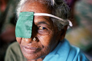 WHO releases new global estimates on visual impairment