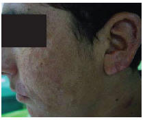 Figure 2 Patient 1 after treatment