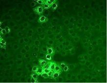 Coronavirus du syndrome respiratoire du Moyen-Orient (MERS-CoV)