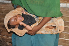 An infant waits for treatment in a hospital  in Thatta, Sindh